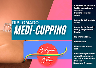 Cupping